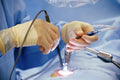 Minimal Invasive Surgery